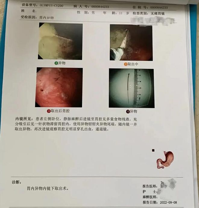 全网愤怒！误将IM电竞 电子竞技平台5厘米长针掉进小孩胃中家长讨说法反遭嘲讽(图7)